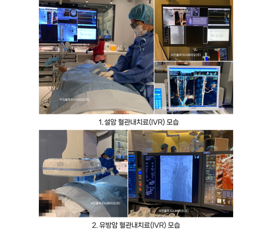 [월간암]설암 등 두경부암에 대해 부작용 거의 없는 비수술적치료 PDT,…