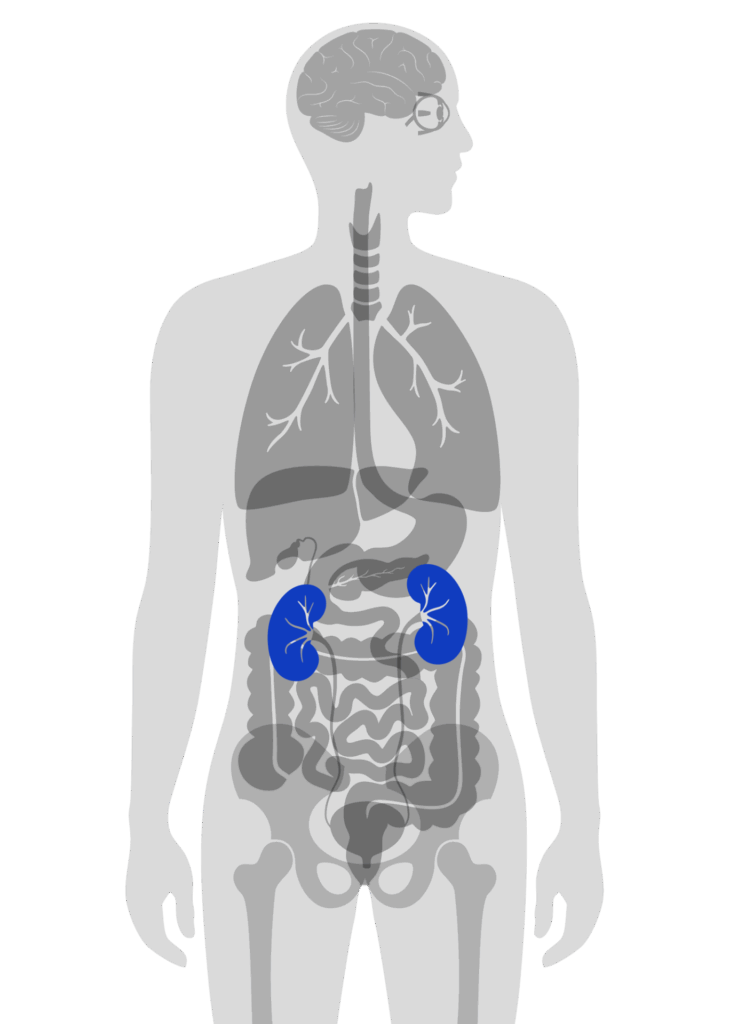8.신장암
